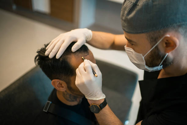 زراعة الشعر المبتكرة في دبي لنتائج رائعة